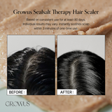 [Clearance] Sea Salt Therapy Scalp Scaler