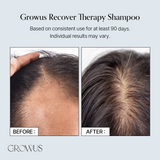 Recover Therapy Shampoo for Woman