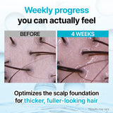 Recover Therapy Hair Booster Serum (15ml / 0.51 fl.oz.)